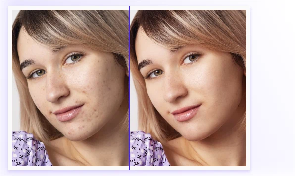 Embelezar a foto para aumentar a nota de beleza